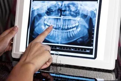 digital panorex used at Ronald Furhmann DDS